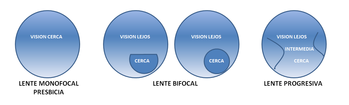 Imagen gafas de presbicia o vista cansada Asociación Española de Optometristas Unidos
