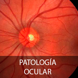 Cursos de Patología ocular para profesionales de la salud visual