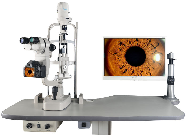 Imagen diagnóstico de la uveítis de la Asociación Española de Optometristas Unidos